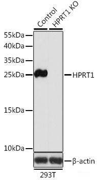 Western blot analysis of extracts of various cell lines using RPS12 Polyclonal Antibody at dilution of 1:1000.