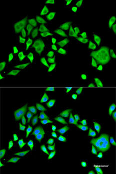 Western blot analysis of extracts of various cell lines using MRPL28 Polyclonal Antibody at dilution of 1:1000.