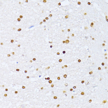 Immunohistochemistry of paraffin-embedded Human gastric using NCL Polyclonal Antibody at dilution of 1:200 (40x lens).