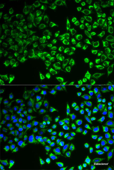 Western blot analysis of extracts of various cell lines using EIF1AX Polyclonal Antibody at dilution of 1:1000.