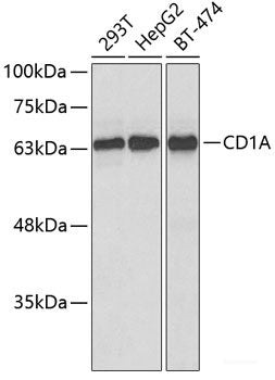 Immunohistochemistry of paraffin-embedded Rat liver using POLR2B Polyclonal Antibody at dilution of 1:100 (40x lens).