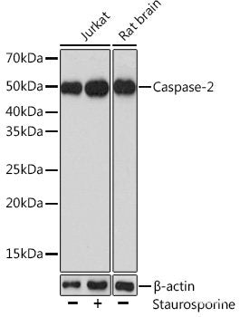 Western blot analysis of extracts of various cell lines using RPL7 Polyclonal Antibody at dilution of 1:3000.