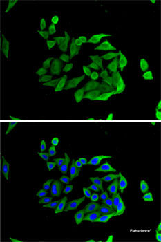 Western blot analysis of extracts of various cell lines using SRPR Polyclonal Antibody at dilution of 1:1000.