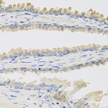 Immunofluorescence analysis of L-929 cells using EIF3D Polyclonal Antibody at dilution of 1:100. Blue: DAPI for nuclear staining.