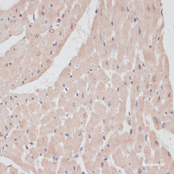 Immunohistochemistry of paraffin-embedded Mouse brain using UTP14A Polyclonal Antibody at dilution of 1:100 (40x lens).
