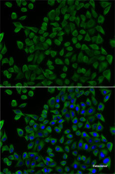 Western blot analysis of extracts of HL-60 cells using G3BP2 Polyclonal Antibody at dilution of 1:1000.