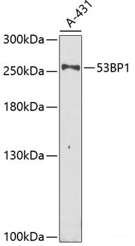 Immunohistochemistry of paraffin-embedded Rat liver using HDLBP Polyclonal Antibody at dilution of 1:100 (40x lens).