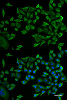 Western blot analysis of extracts of various cell lines using HNRNPA0 Polyclonal Antibody at dilution of 1:3000.