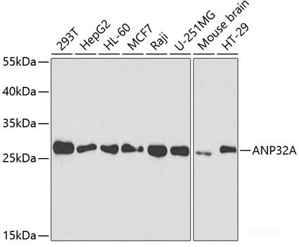 Immunohistochemistry of paraffin-embedded Rat brain using RPS10 Polyclonal Antibody at dilution of 1:100 (40x lens).
