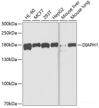 Western blot analysis of extracts of various cell lines using SNRNP70 Polyclonal Antibody at dilution of 1:1000.