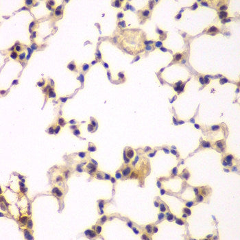 Immunofluorescence analysis of U2OS cells using SFRS9 Polyclonal Antibody at dilution of 1:100. Blue: DAPI for nuclear staining.