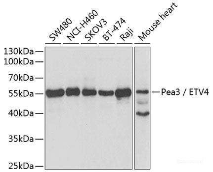 Western blot analysis of extracts of various cell lines using FMR1 Polyclonal Antibody at dilution of 1:1000.