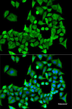 Immunohistochemistry of paraffin-embedded Rat testis using IGF2BP3 Polyclonal Antibody at dilution of 1:100 (40x lens).