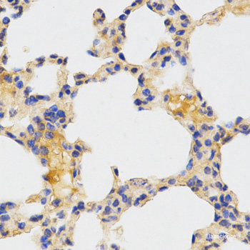Immunofluorescence analysis of U2OS cells using TNRC6A Polyclonal Antibody at dilution of 1:100. Blue: DAPI for nuclear staining.