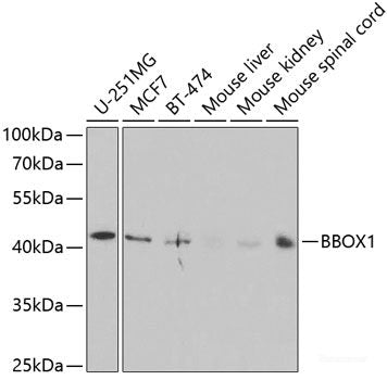Immunohistochemistry of paraffin-embedded Rat brain using CRABP2 Polyclonal Antibody at dilution of 1:100 (40x lens).