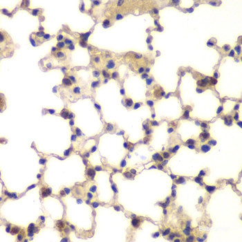 Western blot analysis of extracts of various cell lines using KLRK1 Polyclonal Antibody at dilution of 1:1000.