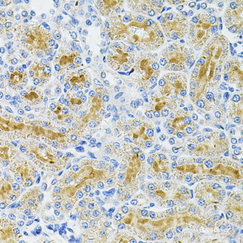 Immunofluorescence analysis of C6 cells using CSF2 Polyclonal Antibody at dilution of 1:100. Blue: DAPI for nuclear staining.