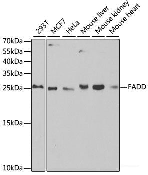 Western blot analysis of extracts of Mouse liver using GSTZ1 Polyclonal Antibody.