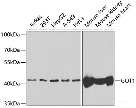 Immunohistochemistry of paraffin-embedded Mouse lung using ERBB4 Polyclonal Antibody at dilution of 1:100 (40x lens).