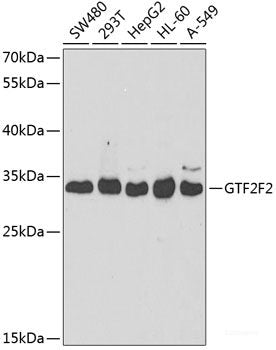 Western blot analysis of extracts of various cell lines using HDAC11 Polyclonal Antibody at dilution of 1:1000.
