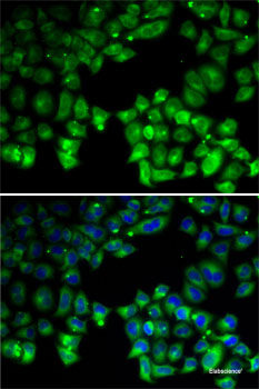 Immunohistochemistry of paraffin-embedded Rat ovary using KMT2E Polyclonal Antibody at dilution of 1:200 (40x lens).