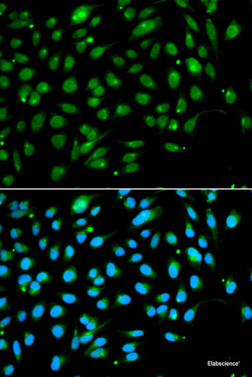 Immunofluorescence analysis of MCF-7 cells using CTCFL Polyclonal Antibody