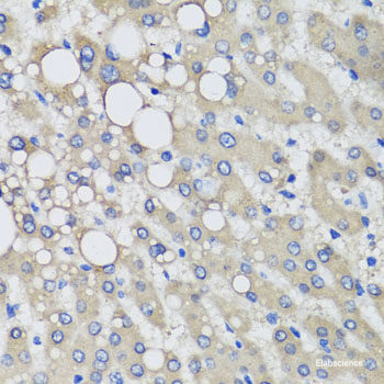 Western blot analysis of extracts of Mouse brain using FAIM2 Polyclonal Antibody at dilution of 1:1000.
