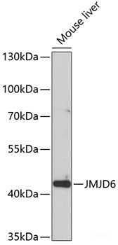 Western blot analysis of extracts of various cell lines using HMGN1 Polyclonal Antibody at dilution of 1:1000.