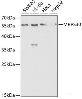 Immunofluorescence analysis of HeLa cells using HMGN2 Polyclonal Antibody