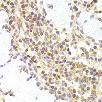 Immunohistochemistry of paraffin-embedded Human prostate using OSM Polyclonal Antibody at dilution of 1:100 (40x lens).