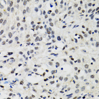 Immunohistochemistry of paraffin-embedded Human kidney using SMYD5 Polyclonal Antibody