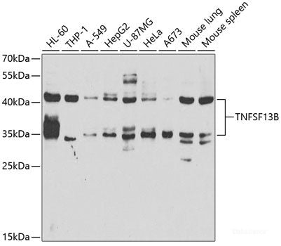 Western blot analysis of extracts of Mouse pancreas using RNASE1 Polyclonal Antibody at dilution of 1:1000.