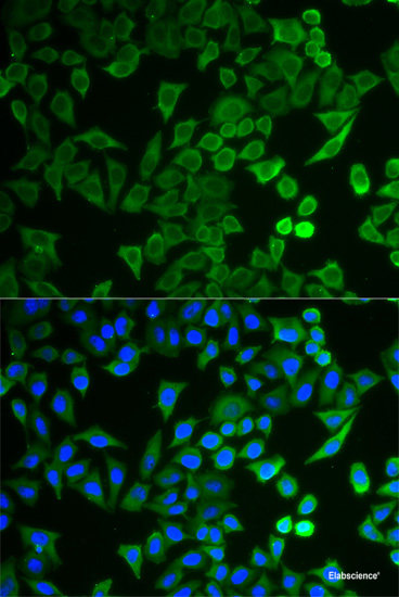 Immunohistochemistry of paraffin-embedded Human stomach using KCND2 Polyclonal Antibody at dilution of 1:100 (40x lens).