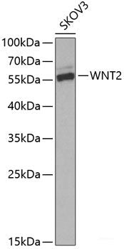 Immunofluorescence analysis of Human liver cancer using SERPINE1 Polyclonal Antibody at dilution of 1:100 (40x lens). Blue: DAPI for nuclear staining.
