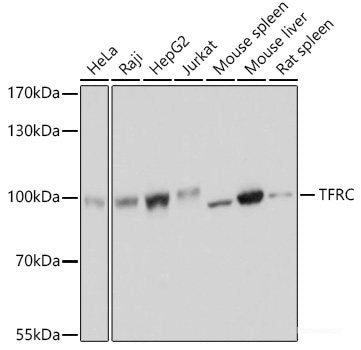Immunohistochemistry of paraffin-embedded Mouse kidney using SET Polyclonal Antibody at dilution of 1:100 (40x lens).