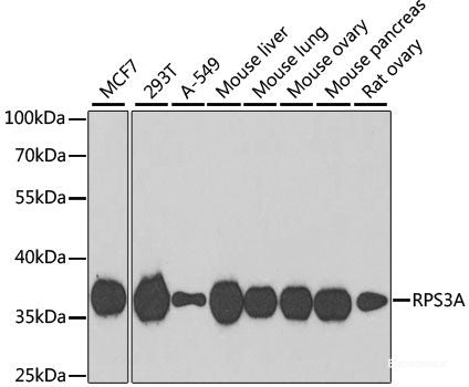 Immunofluorescence analysis of C6 cells using TADA3 Polyclonal Antibody at dilution of 1:100. Blue: DAPI for nuclear staining.