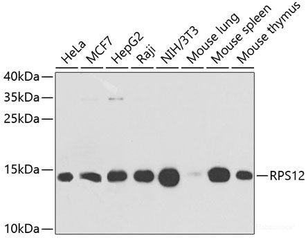 Immunohistochemistry of paraffin-embedded Mouse testis using FDFT1 Polyclonal Antibody at dilution of 1:100 (20x lens).