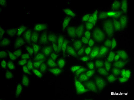 Immunofluorescence analysis of MCF7 cells using TCN1 Polyclonal Antibody