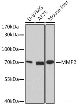 Immunohistochemistry of paraffin-embedded Rat ovary using COX5A Polyclonal Antibody at dilution of 1:100 (40x lens).