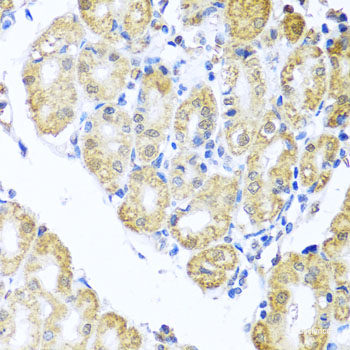Immunofluorescence analysis of HeLa cells using DIDO1 Polyclonal Antibody