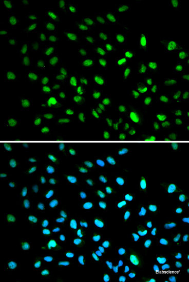 Immunohistochemistry of paraffin-embedded Human stomach using NHLRC1 Polyclonal Antibody at dilution of 1:100 (40x lens).