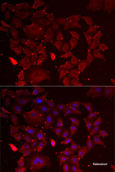 Western blot analysis of extracts of various cell lines using NR2C1 Polyclonal Antibody at dilution of 1:1000.