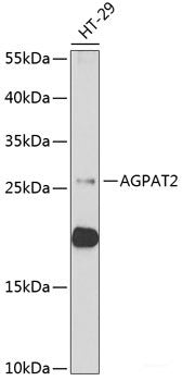 Immunofluorescence analysis of HeLa cells using NSFL1C Polyclonal Antibody