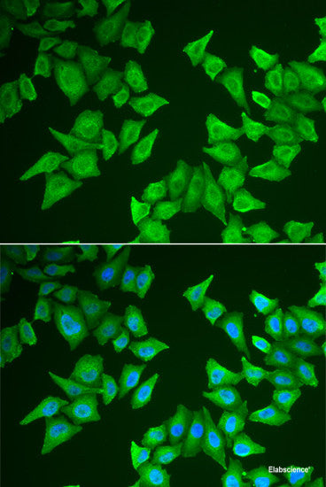 Western blot analysis of extracts of various cell lines using P2RX4 Polyclonal Antibody at dilution of 1:1000.