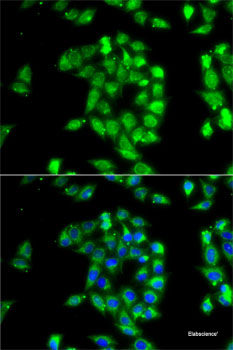 Western blot analysis of extracts of various cell lines using PDCD6 Polyclonal Antibody at dilution of 1:1000.