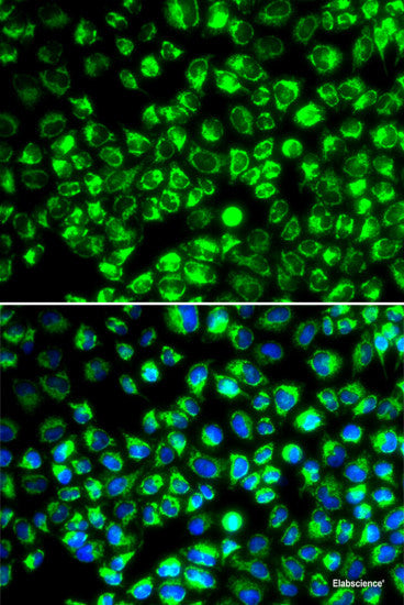 Immunohistochemistry of paraffin-embedded Rat heart using POLG2 Polyclonal Antibody at dilution of 1:100 (40x lens).