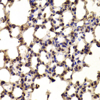 Immunohistochemistry of paraffin-embedded Mouse heart using PPP1R12A Polyclonal Antibody at dilution of 1:100 (40x lens).