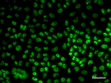 Western blot analysis of extracts of various cell lines using PPP2CA Polyclonal Antibody at dilution of 1:1000.