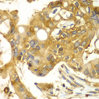 Immunohistochemistry of paraffin-embedded Mouse brain using PROK2 Polyclonal Antibody at dilution of 1:100 (40x lens).