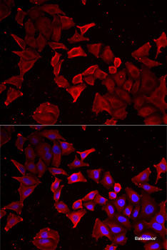 Immunohistochemistry of paraffin-embedded Human kidney using PSMD12 Polyclonal Antibody at dilution of 1:100 (40x lens).